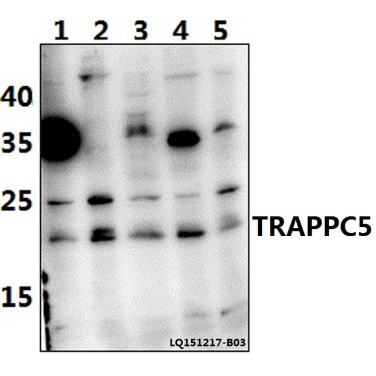 Anti-TRAPPC5 Antibody from Bioworld Technology (BS61465) - Antibodies.com
