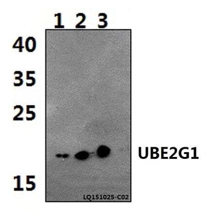 Anti-UBE2G1 Antibody from Bioworld Technology (BS61475) - Antibodies.com