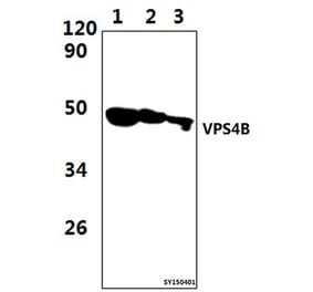 Anti-VPS4B Antibody from Bioworld Technology (BS61477) - Antibodies.com