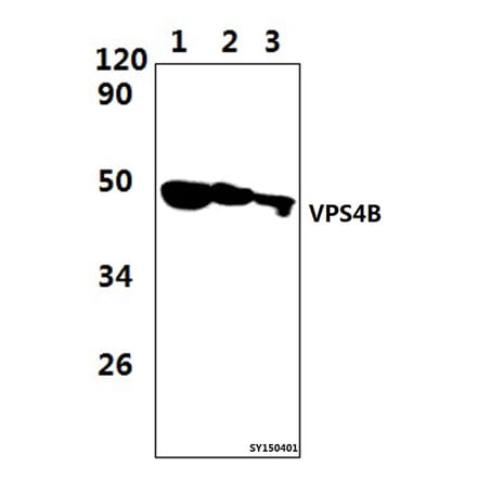 Anti-VPS4B Antibody from Bioworld Technology (BS61477) - Antibodies.com