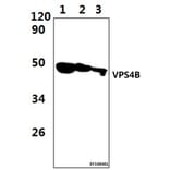 Anti-VPS4B Antibody from Bioworld Technology (BS61477) - Antibodies.com