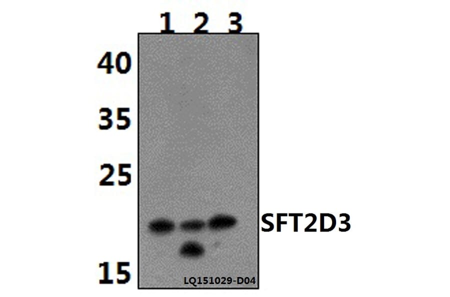 Anti-SFT2D3 Antibody from Bioworld Technology (BS61480) - Antibodies.com