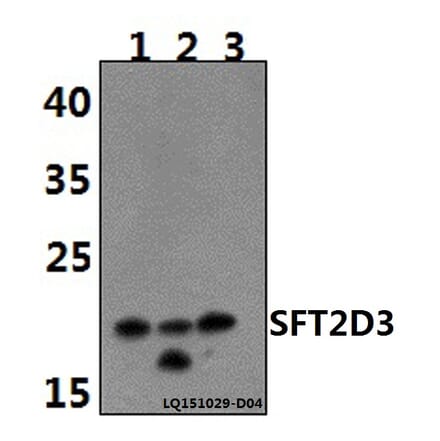 Anti-SFT2D3 Antibody from Bioworld Technology (BS61480) - Antibodies.com
