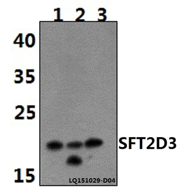 Anti-SFT2D3 Antibody from Bioworld Technology (BS61480) - Antibodies.com