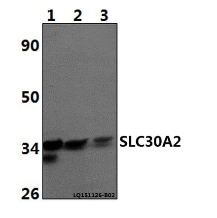 Anti-SLC30A2 Antibody from Bioworld Technology (BS61486) - Antibodies.com