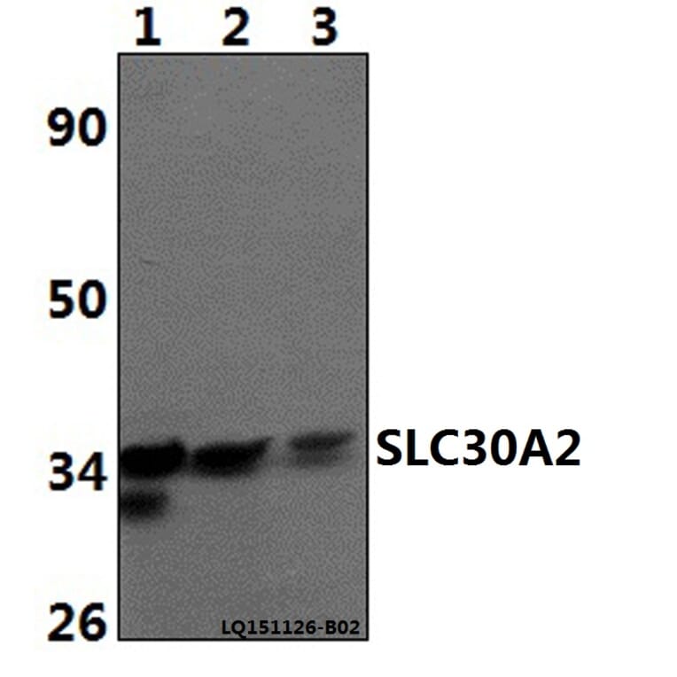Anti-SLC30A2 Antibody from Bioworld Technology (BS61486) - Antibodies.com