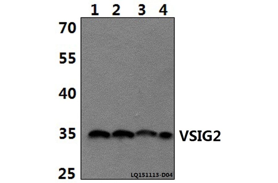 Anti-VSIG2 Antibody from Bioworld Technology (BS61489) - Antibodies.com