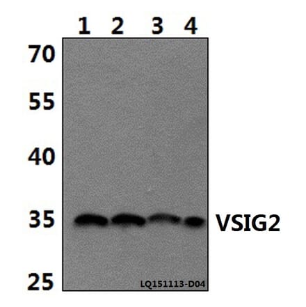 Anti-VSIG2 Antibody from Bioworld Technology (BS61489) - Antibodies.com