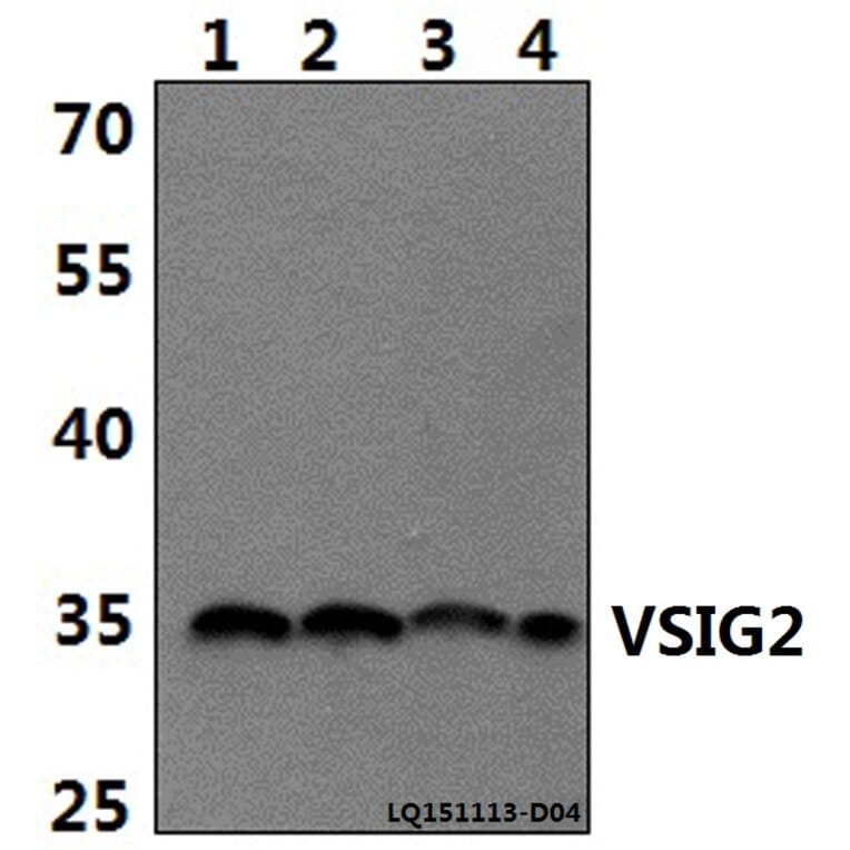 Anti-VSIG2 Antibody from Bioworld Technology (BS61489) - Antibodies.com