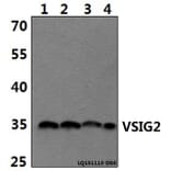 Anti-VSIG2 Antibody from Bioworld Technology (BS61489) - Antibodies.com