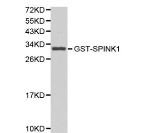Anti-SPINK1 Antibody from Bioworld Technology (BS6149) - Antibodies.com
