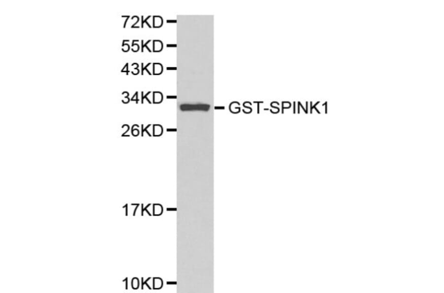 Anti-SPINK1 Antibody from Bioworld Technology (BS6149) - Antibodies.com
