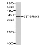 Anti-SPINK1 Antibody from Bioworld Technology (BS6149) - Antibodies.com