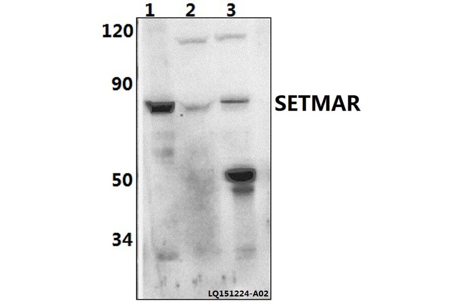 Anti-SETMAR Antibody from Bioworld Technology (BS61494) - Antibodies.com