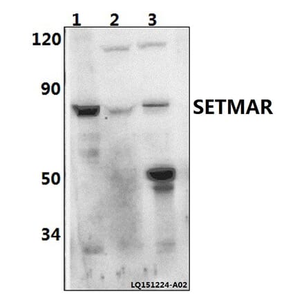 Anti-SETMAR Antibody from Bioworld Technology (BS61494) - Antibodies.com