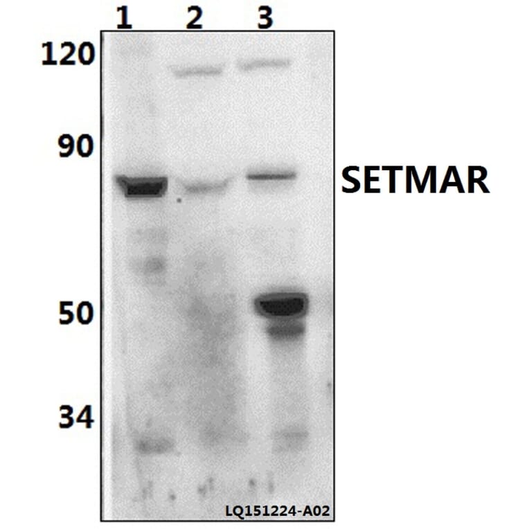 Anti-SETMAR Antibody from Bioworld Technology (BS61494) - Antibodies.com