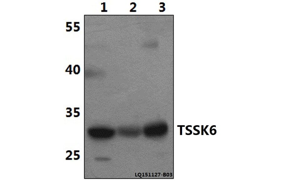 Anti-TSSK6 Antibody from Bioworld Technology (BS61496) - Antibodies.com