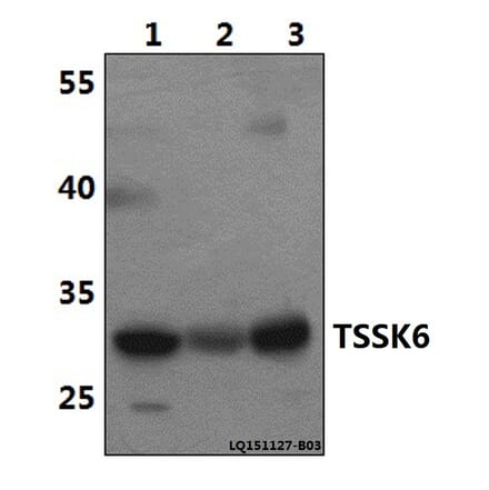 Anti-TSSK6 Antibody from Bioworld Technology (BS61496) - Antibodies.com