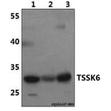 Anti-TSSK6 Antibody from Bioworld Technology (BS61496) - Antibodies.com