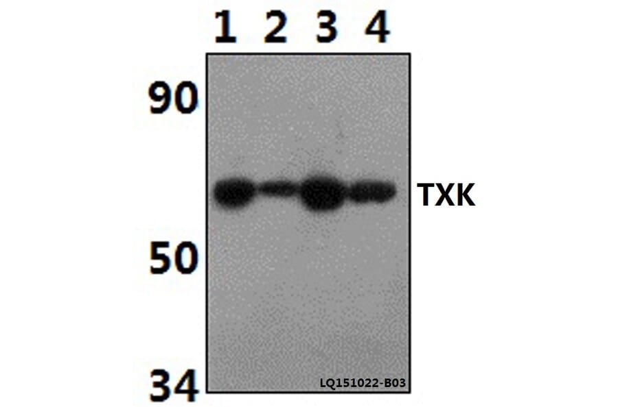 Anti-TXK Antibody from Bioworld Technology (BS61497) - Antibodies.com