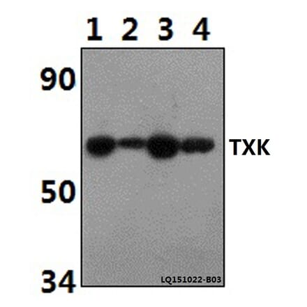 Anti-TXK Antibody from Bioworld Technology (BS61497) - Antibodies.com