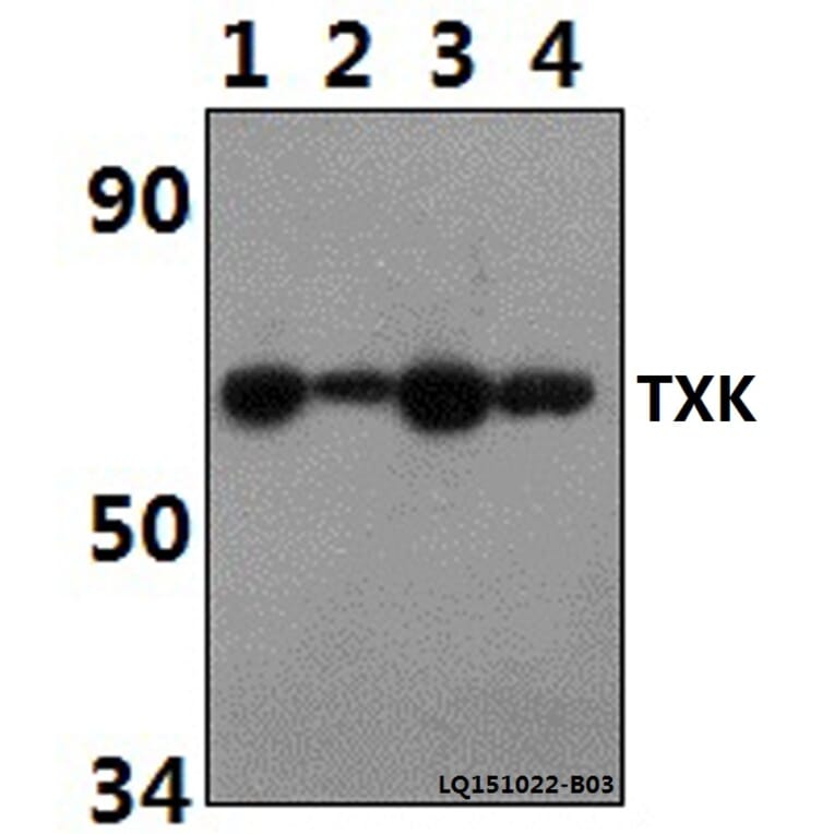 Anti-TXK Antibody from Bioworld Technology (BS61497) - Antibodies.com