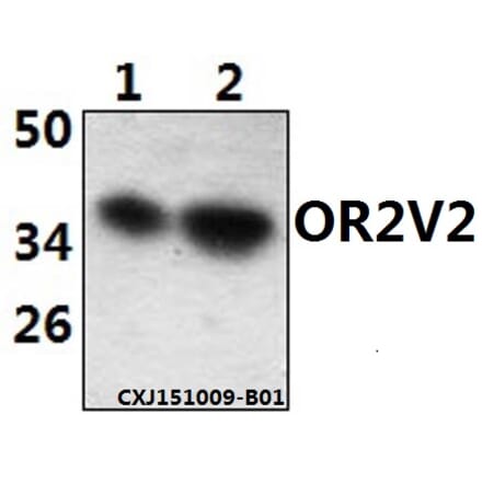 Anti-OR2V2 Antibody from Bioworld Technology (BS61502) - Antibodies.com