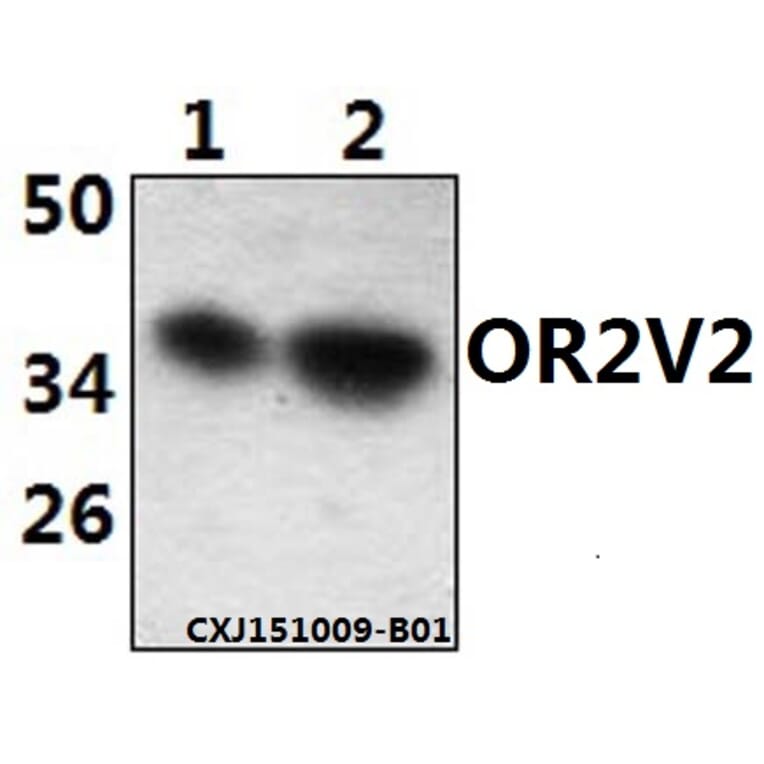 Anti-OR2V2 Antibody from Bioworld Technology (BS61502) - Antibodies.com