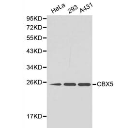 Anti-CBX5 Antibody from Bioworld Technology (BS6151) - Antibodies.com