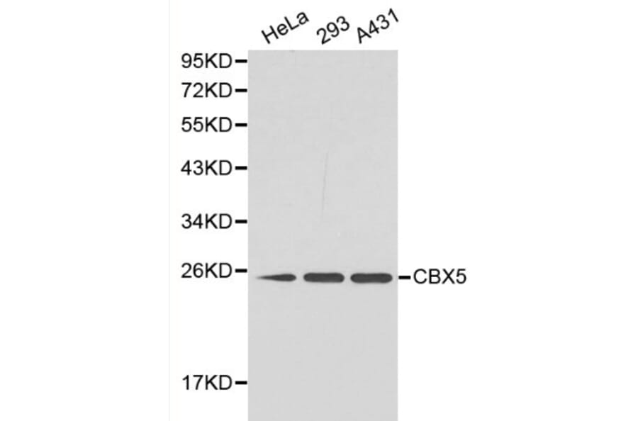 Anti-CBX5 Antibody from Bioworld Technology (BS6151) - Antibodies.com