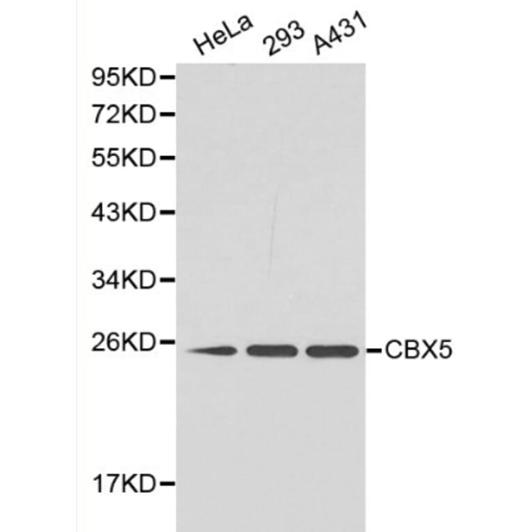 Anti-CBX5 Antibody from Bioworld Technology (BS6151) - Antibodies.com