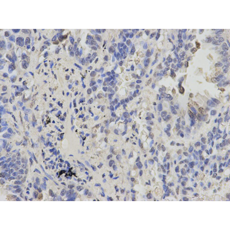 Anti-CBX5 Antibody from Bioworld Technology (BS6151) - Antibodies.com