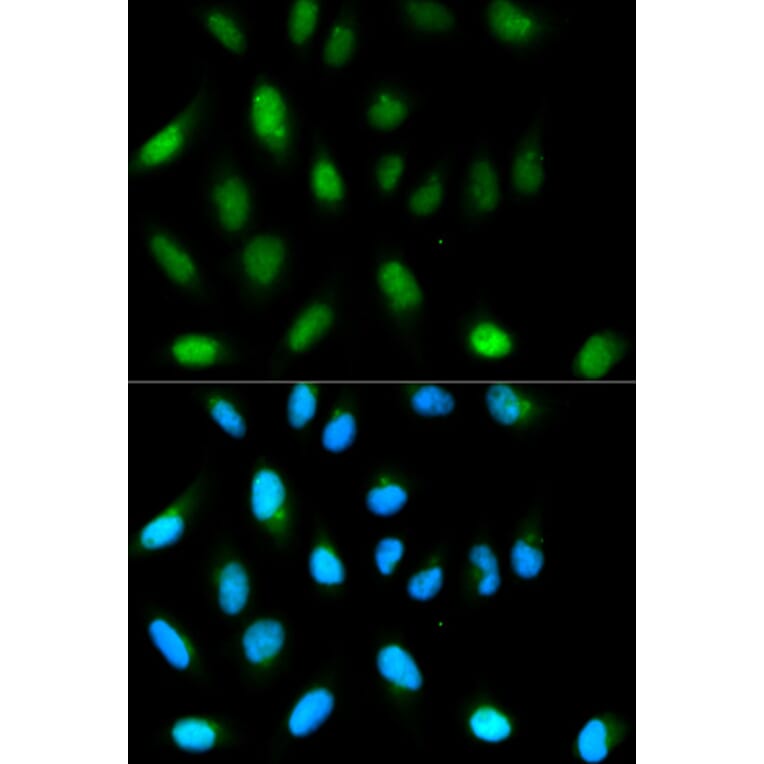 Anti-CBX5 Antibody from Bioworld Technology (BS6151) - Antibodies.com