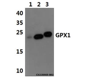 Anti-GPX1 Antibody from Bioworld Technology (BS61511) - Antibodies.com