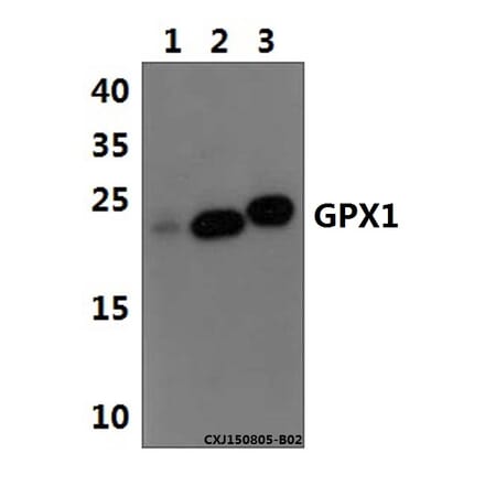 Anti-GPX1 Antibody from Bioworld Technology (BS61511) - Antibodies.com
