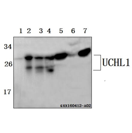 Anti-UCHL1 Antibody from Bioworld Technology (BS61514) - Antibodies.com