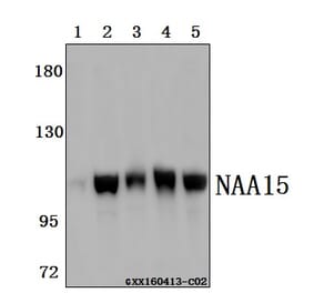 Anti-NAA15 Antibody from Bioworld Technology (BS61517) - Antibodies.com