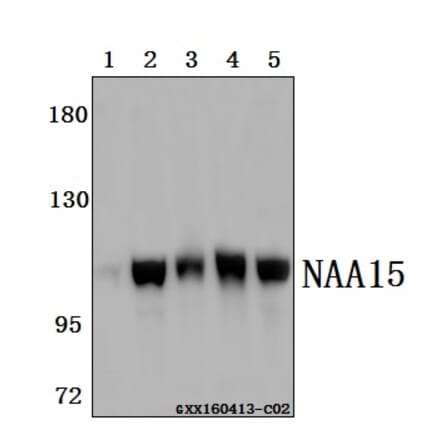 Anti-NAA15 Antibody from Bioworld Technology (BS61517) - Antibodies.com