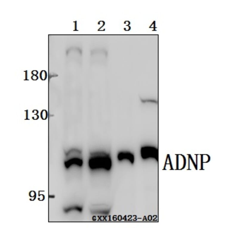 Anti-ADNP Antibody from Bioworld Technology (BS61518) - Antibodies.com