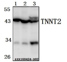 Anti-TNNT2 Antibody from Bioworld Technology (BS61520) - Antibodies.com