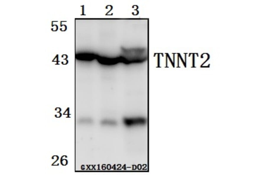 Anti-TNNT2 Antibody from Bioworld Technology (BS61520) - Antibodies.com