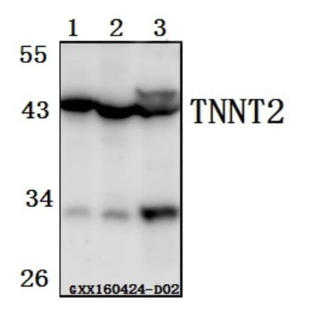 Anti-TNNT2 Antibody from Bioworld Technology (BS61520) - Antibodies.com