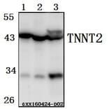 Anti-TNNT2 Antibody from Bioworld Technology (BS61520) - Antibodies.com