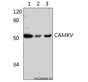 Anti-CAMKV Antibody from Bioworld Technology (BS61522) - Antibodies.com