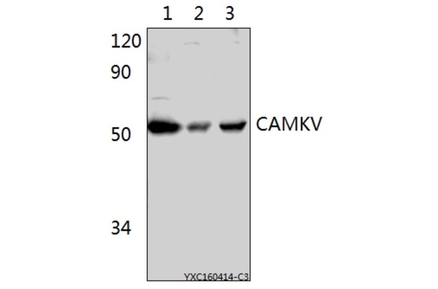 Anti-CAMKV Antibody from Bioworld Technology (BS61522) - Antibodies.com