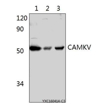 Anti-CAMKV Antibody from Bioworld Technology (BS61522) - Antibodies.com