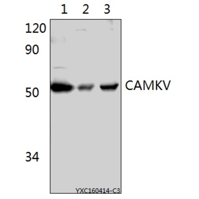 Anti-CAMKV Antibody from Bioworld Technology (BS61522) - Antibodies.com