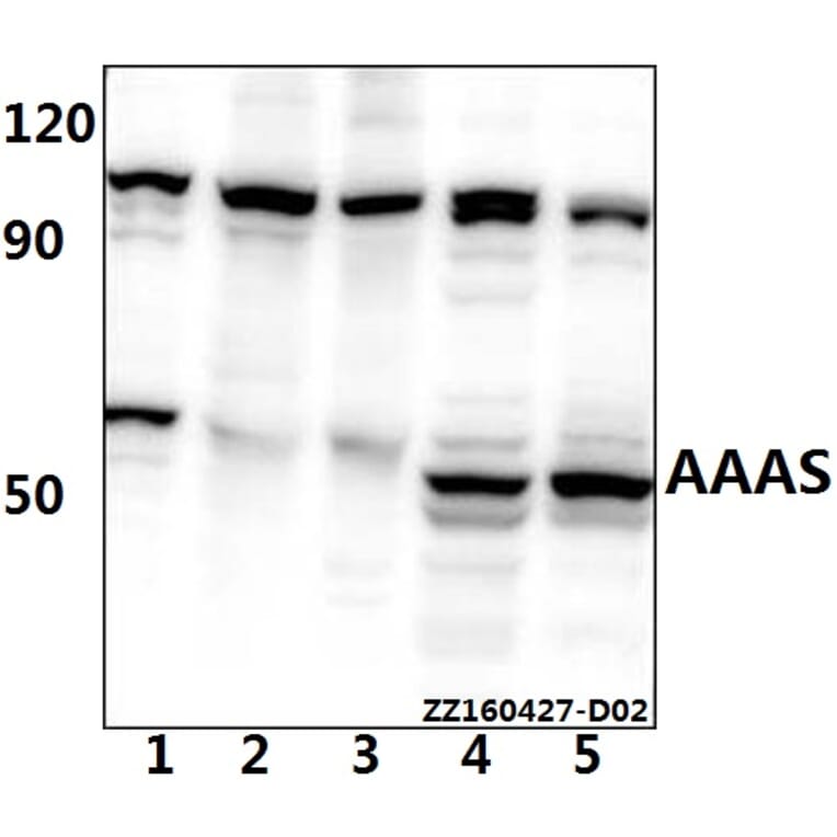 Anti-AVEN Antibody from Bioworld Technology (BS61525) - Antibodies.com
