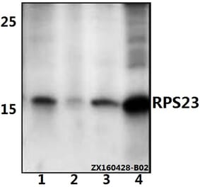 Anti-RPS23 Antibody from Bioworld Technology (BS61528) - Antibodies.com