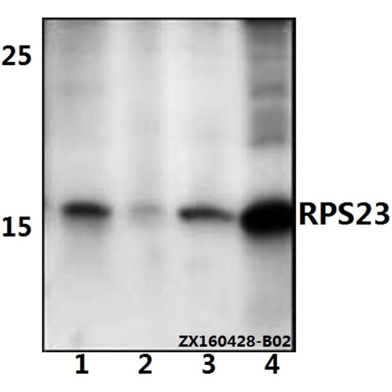 Anti-RPS23 Antibody from Bioworld Technology (BS61528) - Antibodies.com